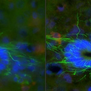 Fluorescence Microscopy