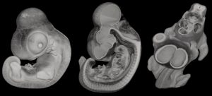 3 Views of an Embryo captured with the optical High Resolution Episcopic Microscope (HREM)